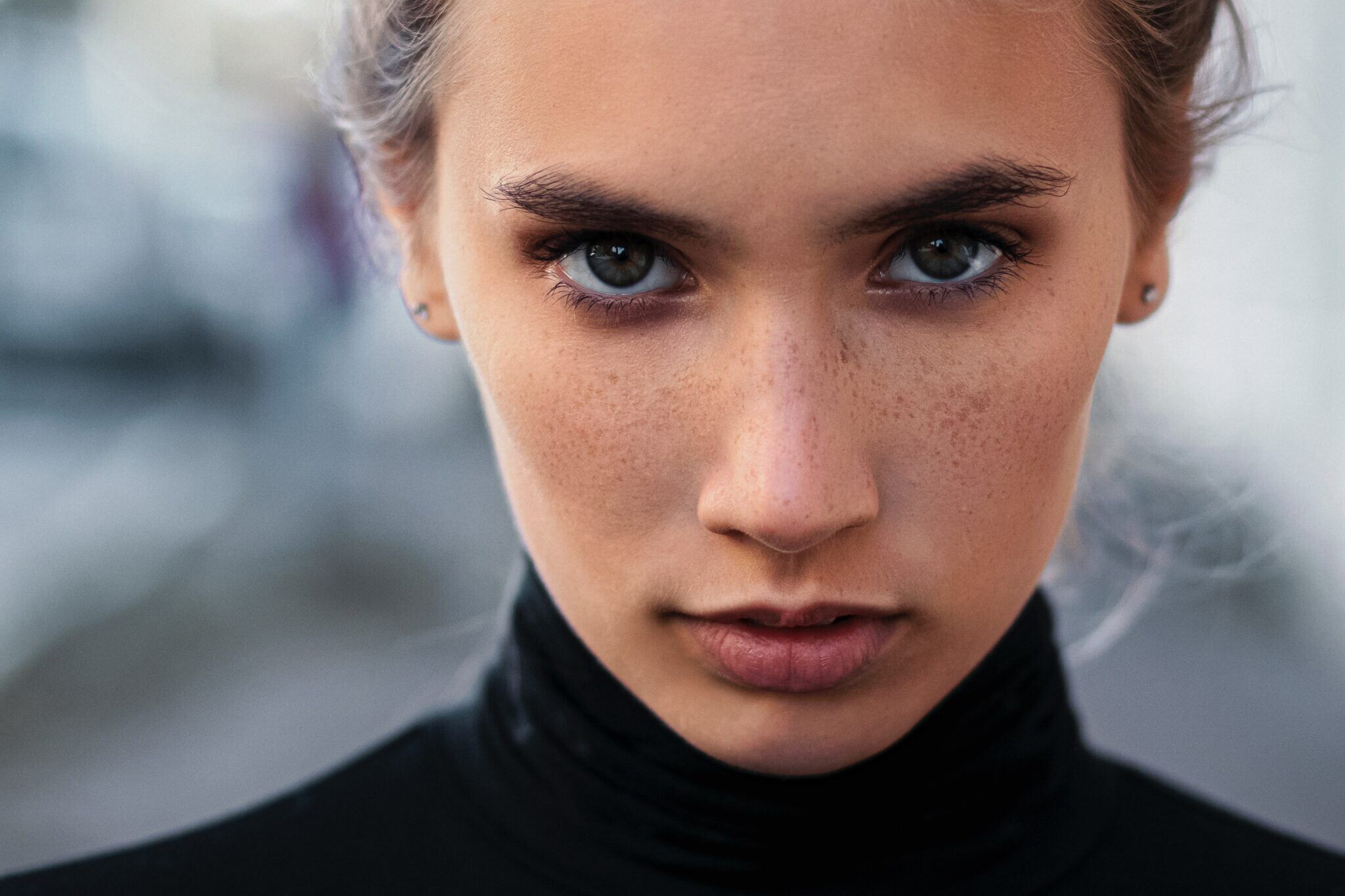 What Are the Benefits of Radiofrequency Microneedling?