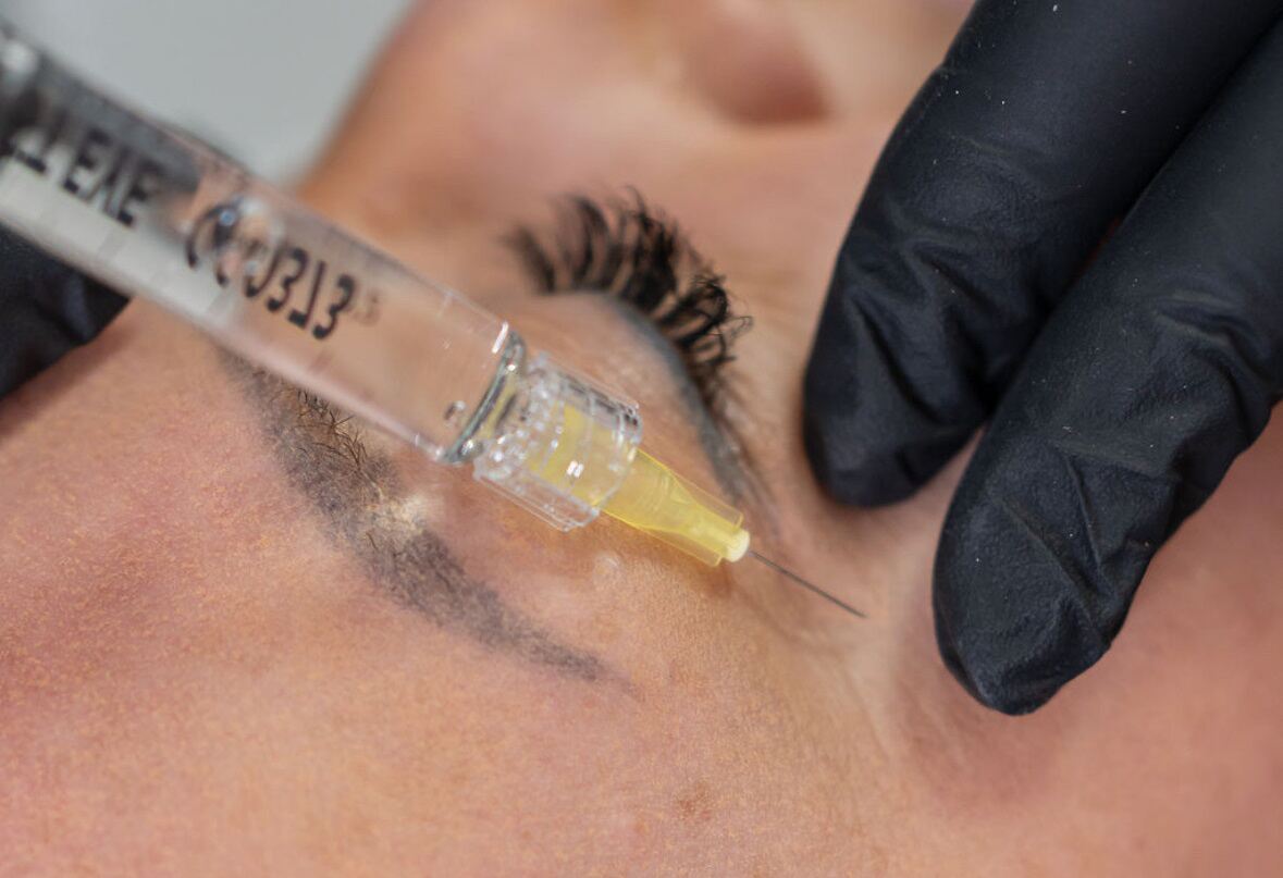How to effectively treat crepey skin around the eyes non-surgically