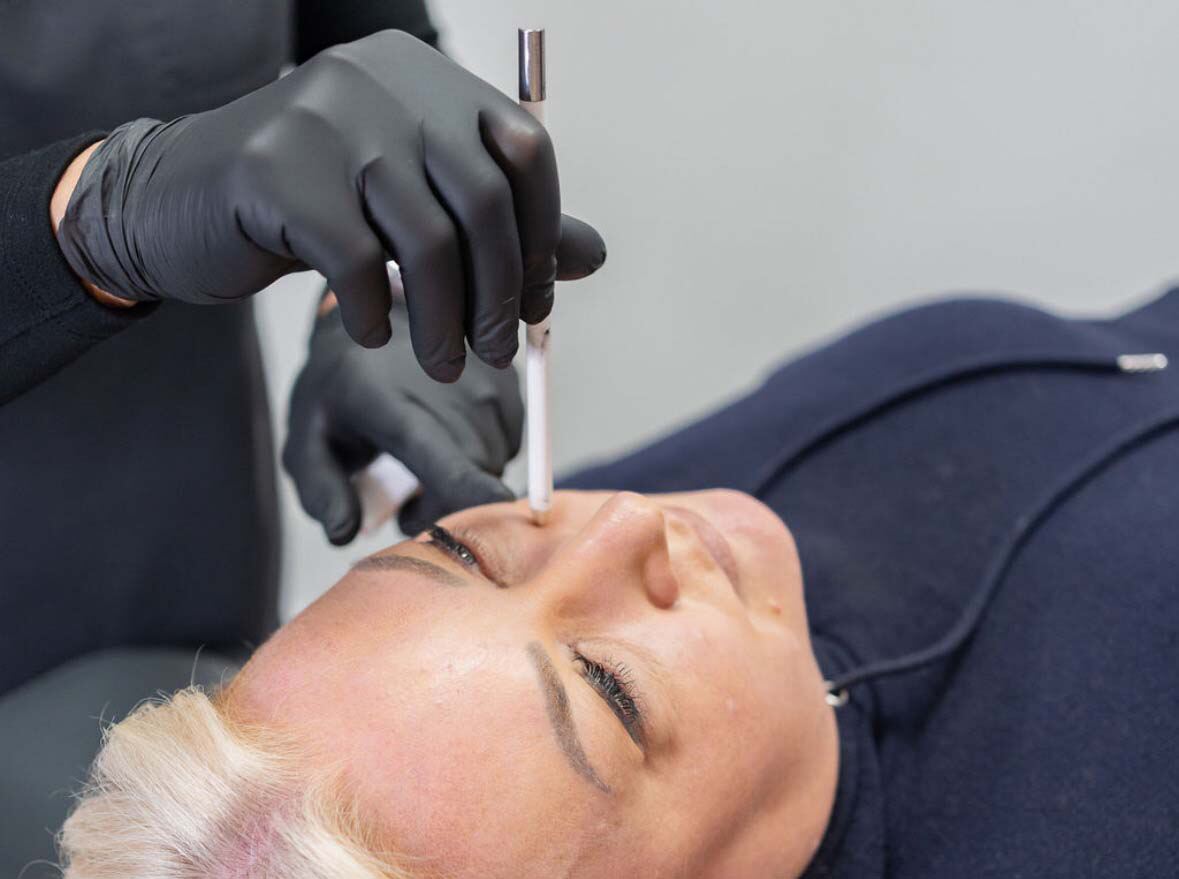 Polynucleotides vs Tear Trough Fillers: What is the difference?