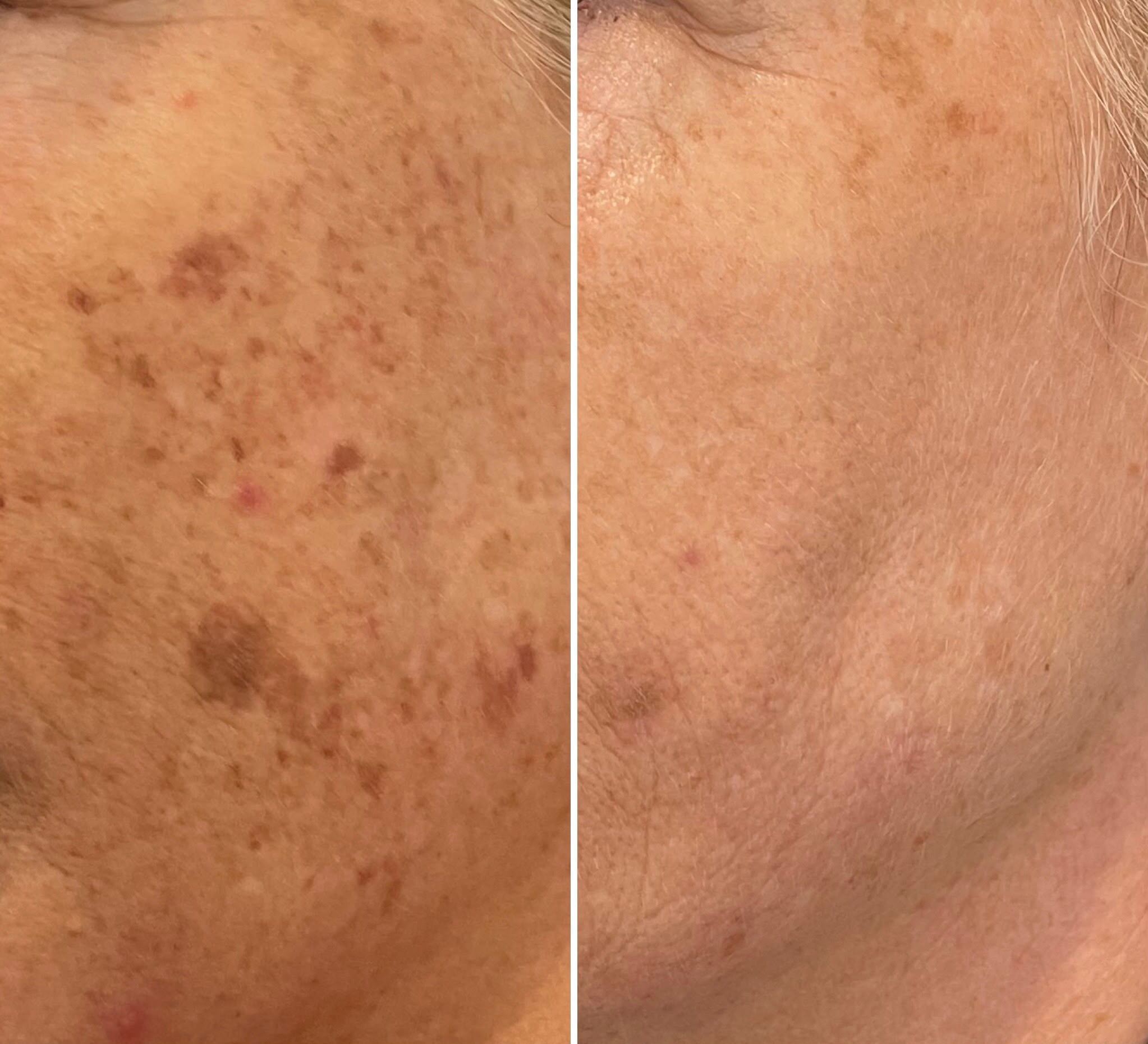 Cosmeceutical vs Medical Grade Skincare: Your Definitive Guide